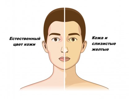 Изменение цвета кожи
