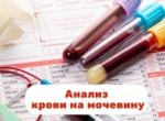 Анализ на мочевину в крови