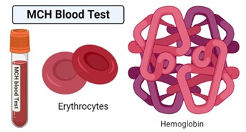 MCH blood test