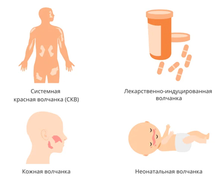 Типы волчанки Типы волчанки
