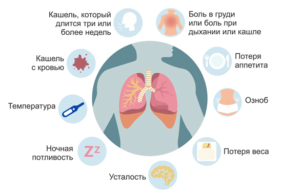 Симптомы туберкулеза
