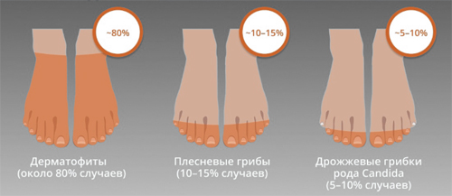 Возбудители грибковых заболеваний ногтей