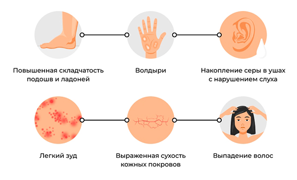 Симптомы ихтиоза Симптомы ихтиоза